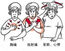 冠心病有哪些癥狀？