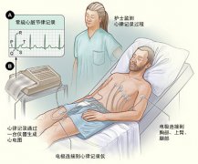 冠心病需要做哪些檢查？