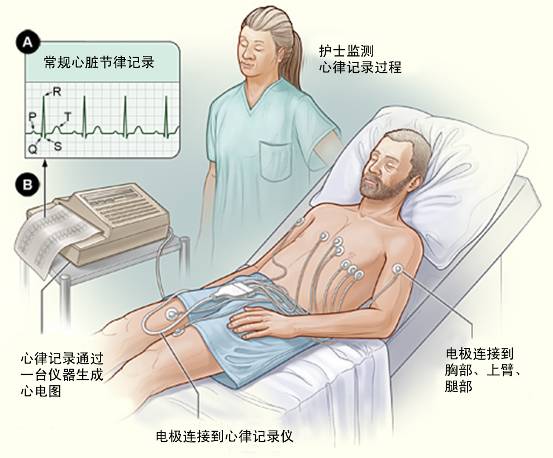 冠心病需要做哪些檢查？(圖1)